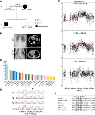 De novo and inherited micro-CNV at 16p13.11 in 21 Chinese patients with defective cardiac left-right patterning